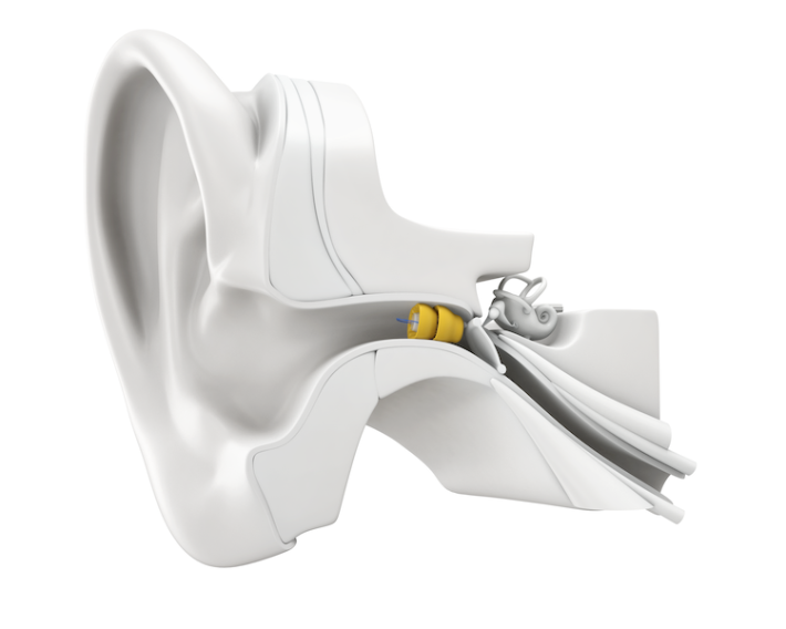 Lyric Hearing Aids Invisible Hearing Aids Without Batteries