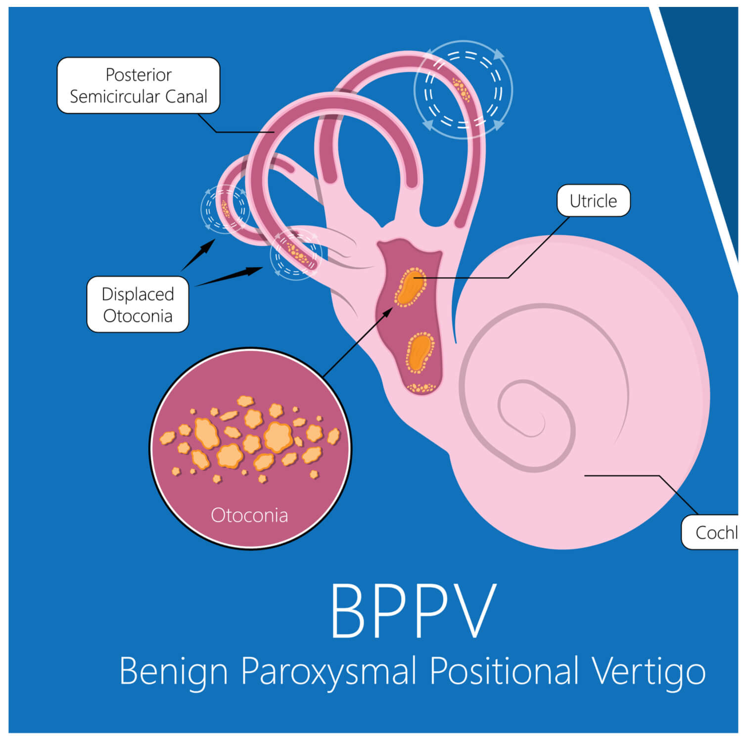 Vertigo and dizziness treatment happy ears hearing center
