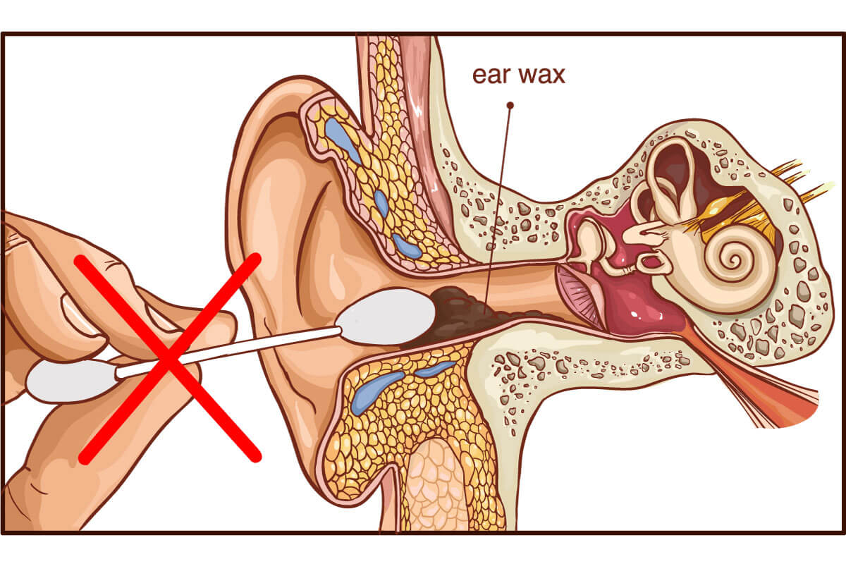 Ear Irrigation - Benefits & side effects